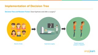 Implementation of Decision Tree
Decision Tree and Random Forest: Does Kyphosis exist after a surgery?
Bunch of kids Kyphosis surgery Predict kyphosis
present or absent?
 
