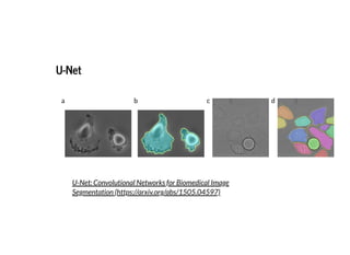 U-NetU-Net
U-Net: Convolutional Networks for Biomedical Image
Segmentation (https://arxiv.org/abs/1505.04597)
 